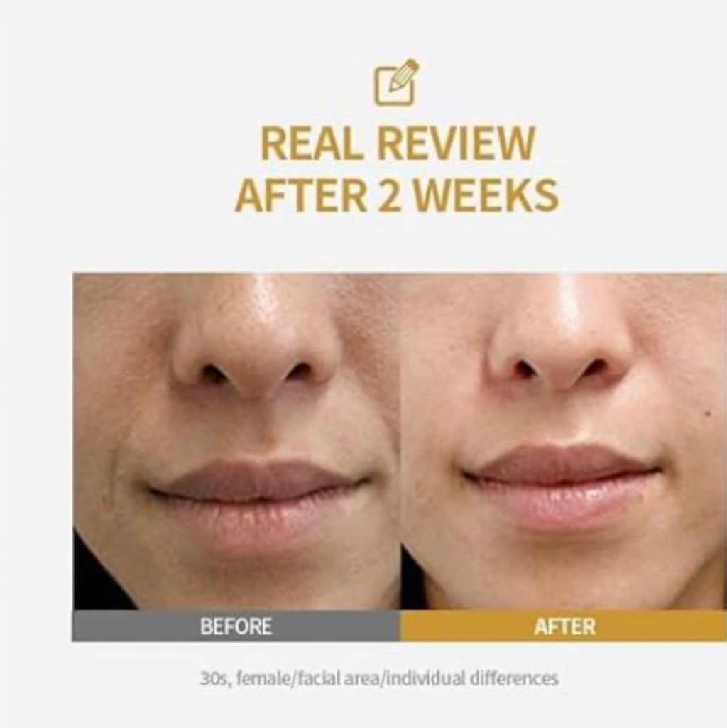 sungboon editor silk peptide intensive lifting ampoule